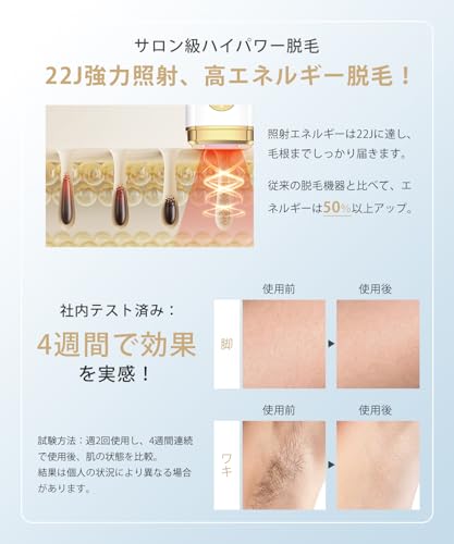 Clyrox - 脱毛器 VIO対応【2025年夏新モデル・IPL・サファイア冷却技術